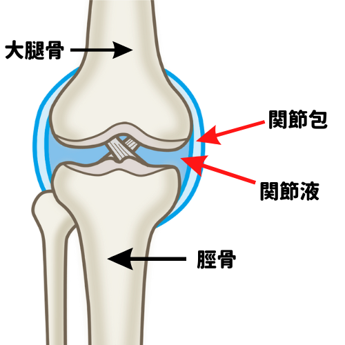 膝に水が溜まるイラスト